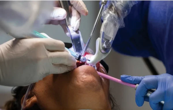Navigation-Assisted Dental Implants in India: The Truth About ‘Robotic’ Implant Surgery